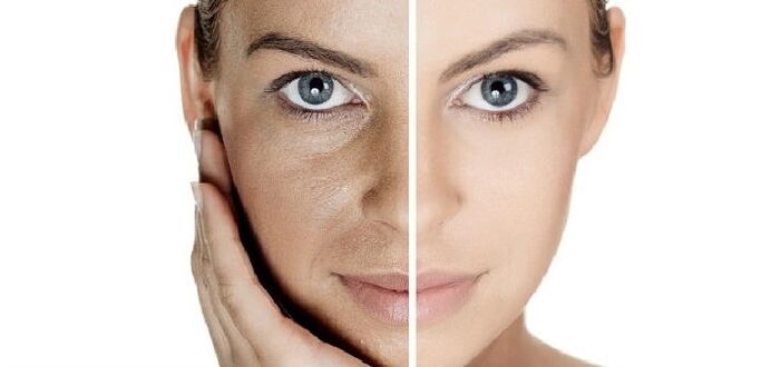 antes e depois do rejuvenescimento da pele facial