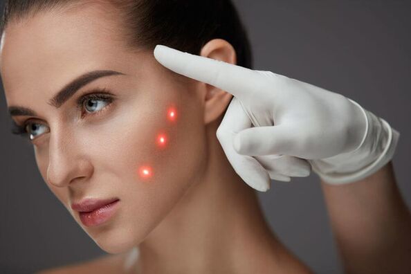 Rejuvenescimento facial a laser